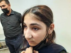 نمونه کار کلینیک پایار (پروتز چشم)3