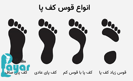 بهترین تمرین برای درمان قوس زیاد کف پا چیست؟